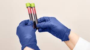 1. Decoding Your Child's Celiac Follow-Up Blood Work 2 image 37