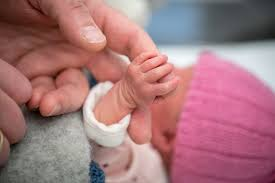 Iron Deficiency Anemia in Premature Infants (